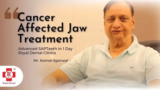 Cancer Affected Jaw Treatment